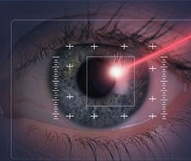 Comparing Eye Surgery