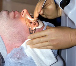 Is Eye Surgery Effective