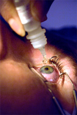 Laser Eye Surgery for Diabetics