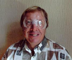 Recovering After Eye Surgery